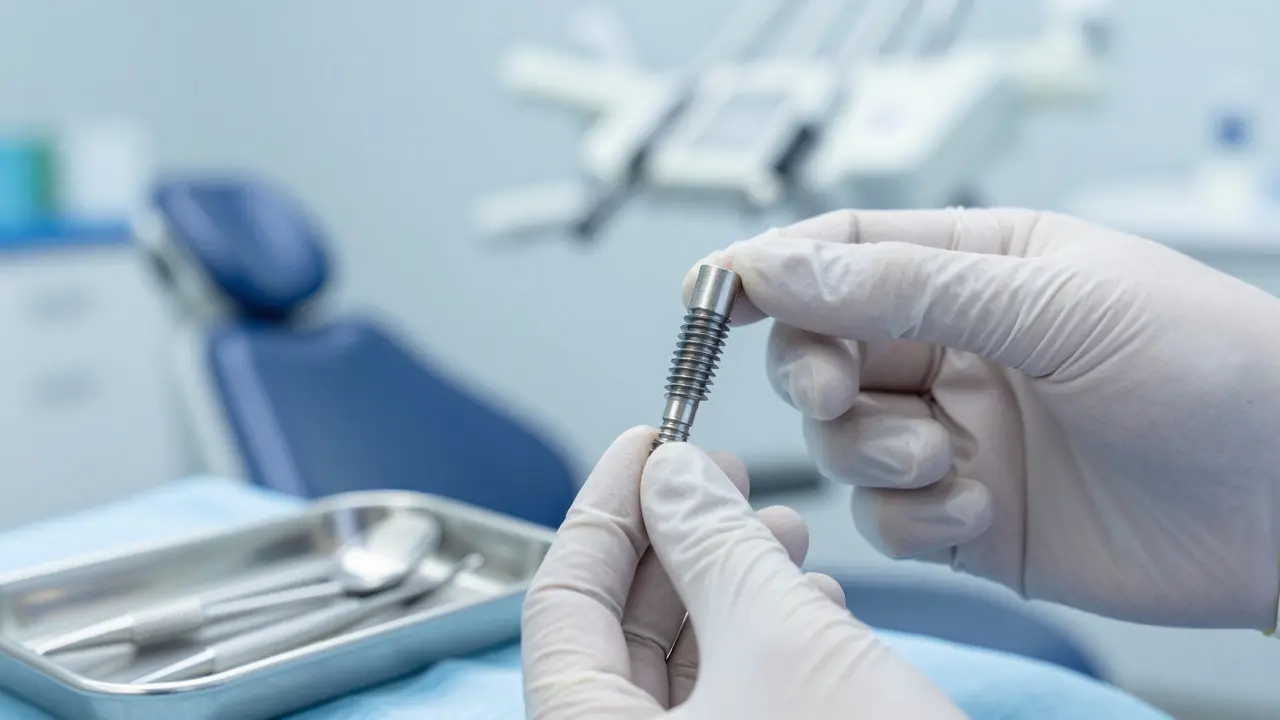 Titánový zubní implantát v rukou chirurga